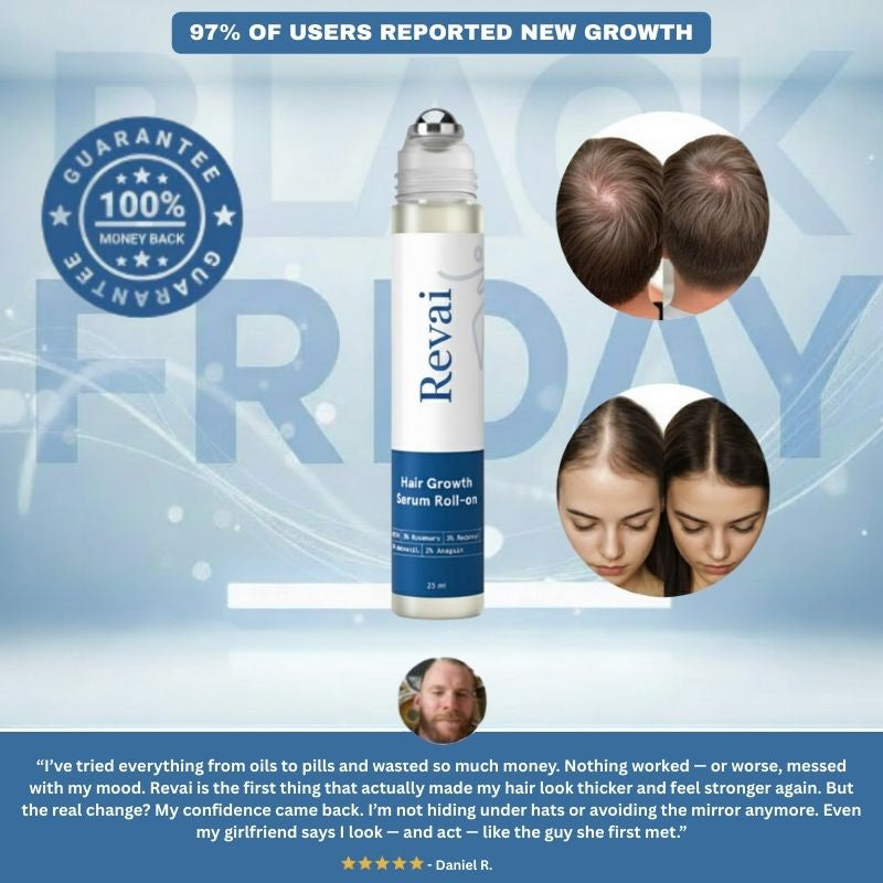 Advanced Hair Growth Roll-on Serum
